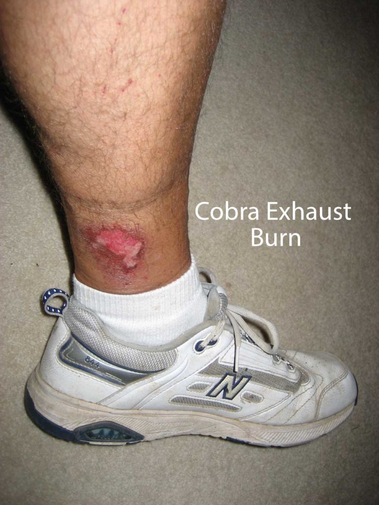 CobraExhaustBurn Koolmat